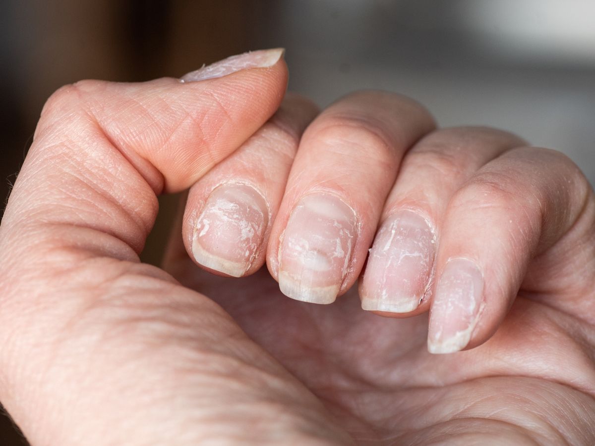 Stop Nail Breakage in Its Tracks: Tips for Strong, Healthy Nails​